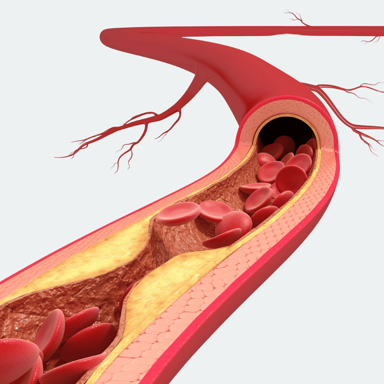 Peripheral Artery Disease Coding Challenge