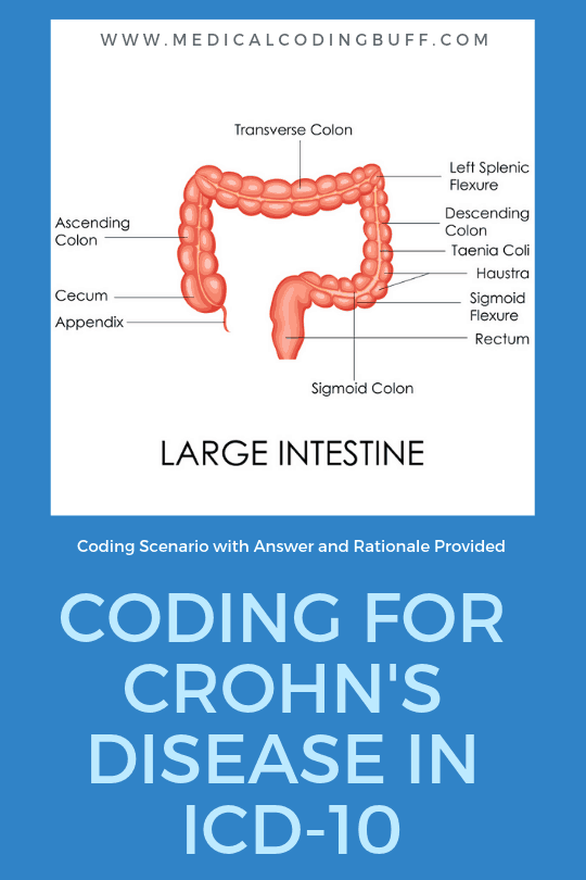 crohn's disease in ICD-10-CM/
