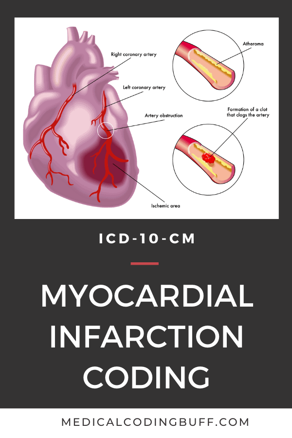 acute myocardial infarction coding in ICD-10-CM