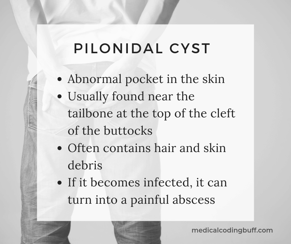Pilonidal cyst definition. facts to look for in documentation in order to code for it in icd-10-cm