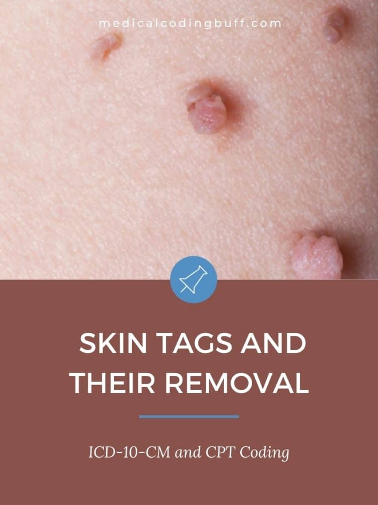 code for skin tags and their removal in icd-10-cm and cpt